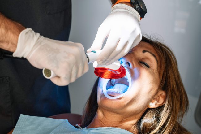 best dental whitening treatment