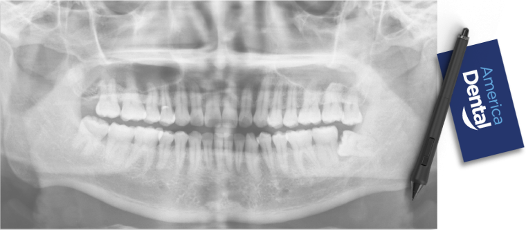 America Dental X-Ray