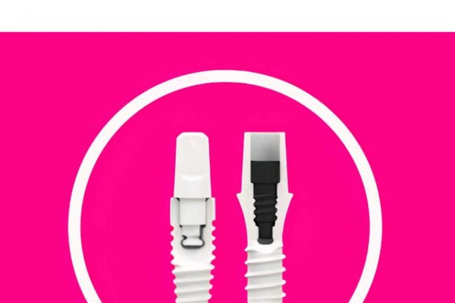 dental-implants-costa-rica
