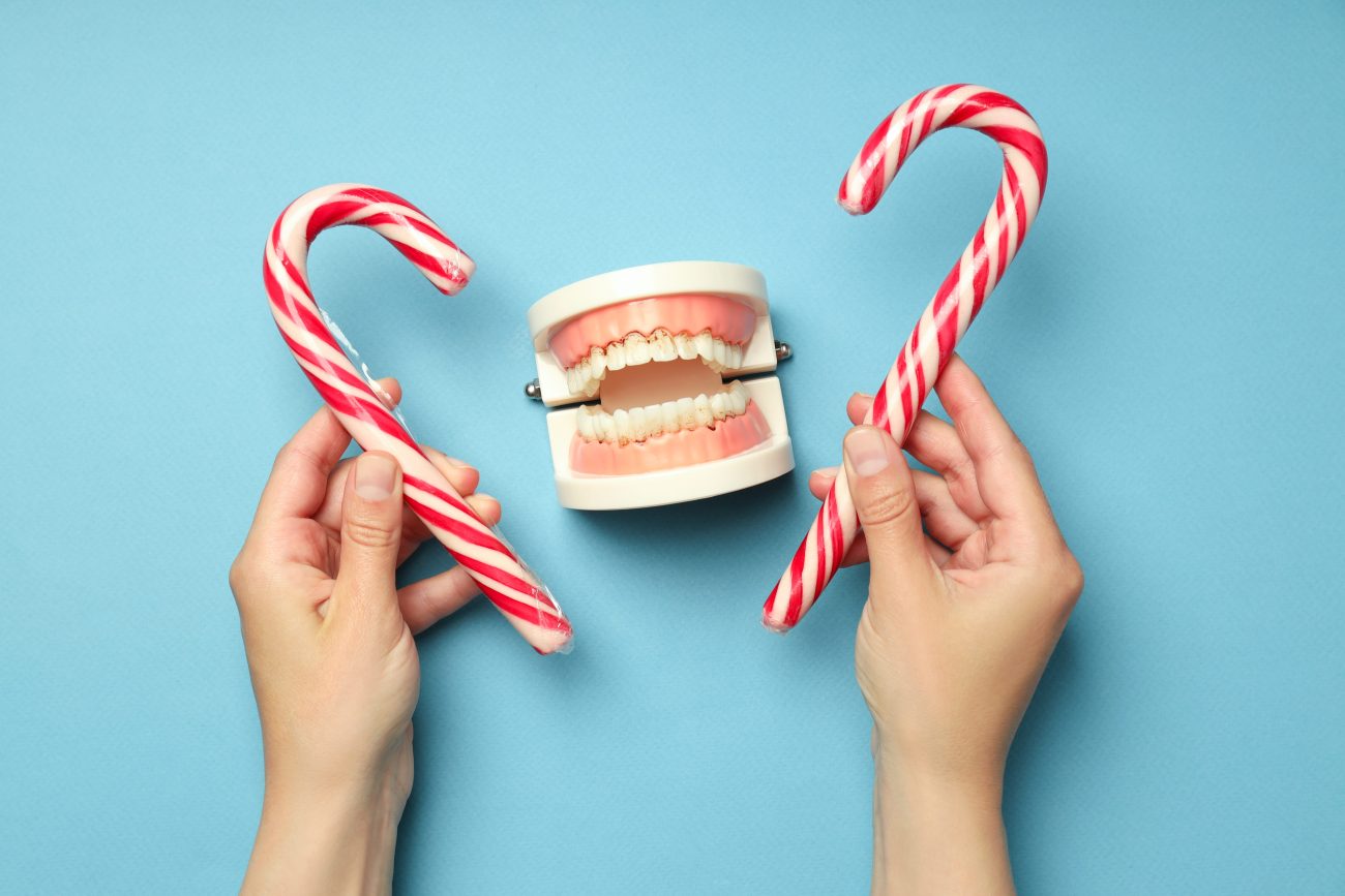 Diet and Oral Health