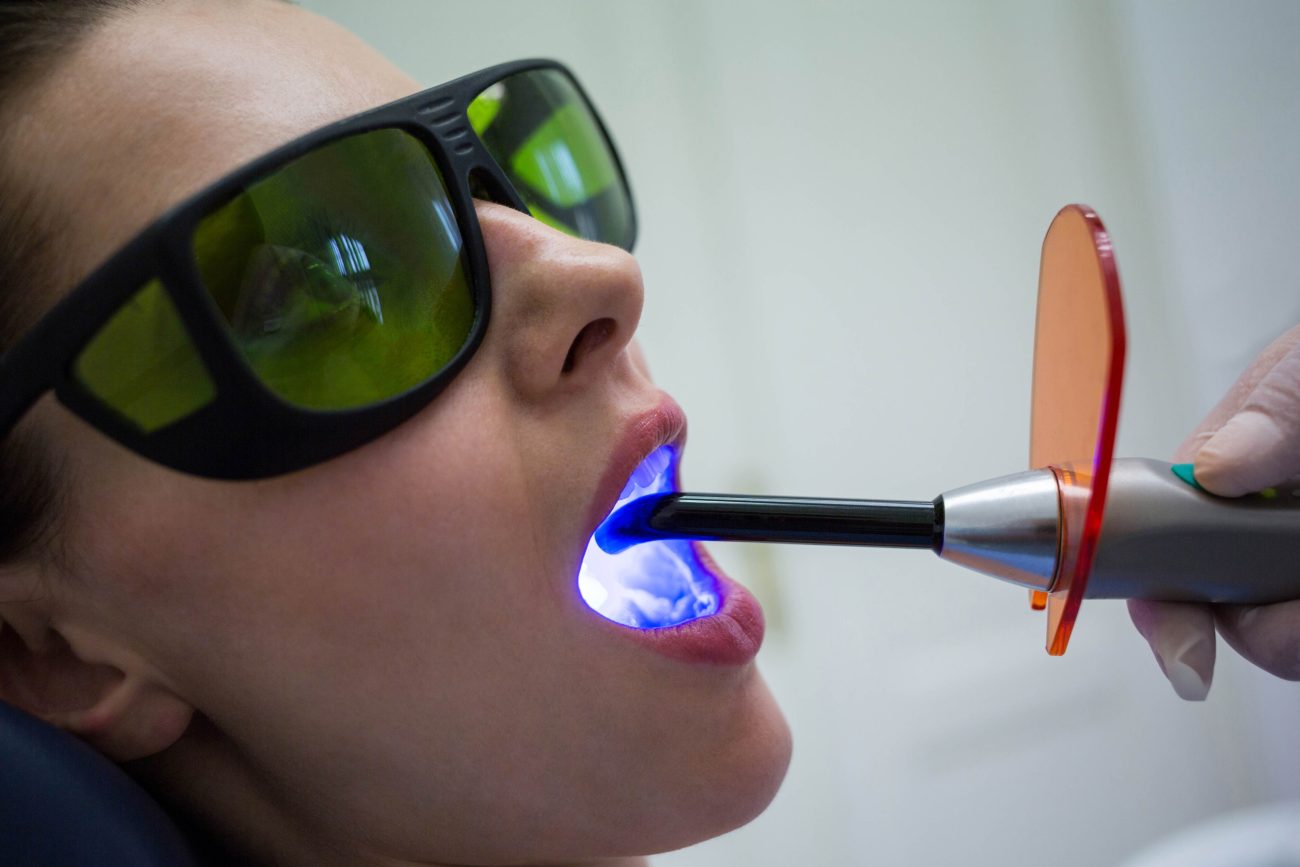 gum laser treatment