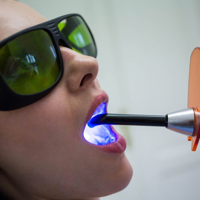 gum laser treatment