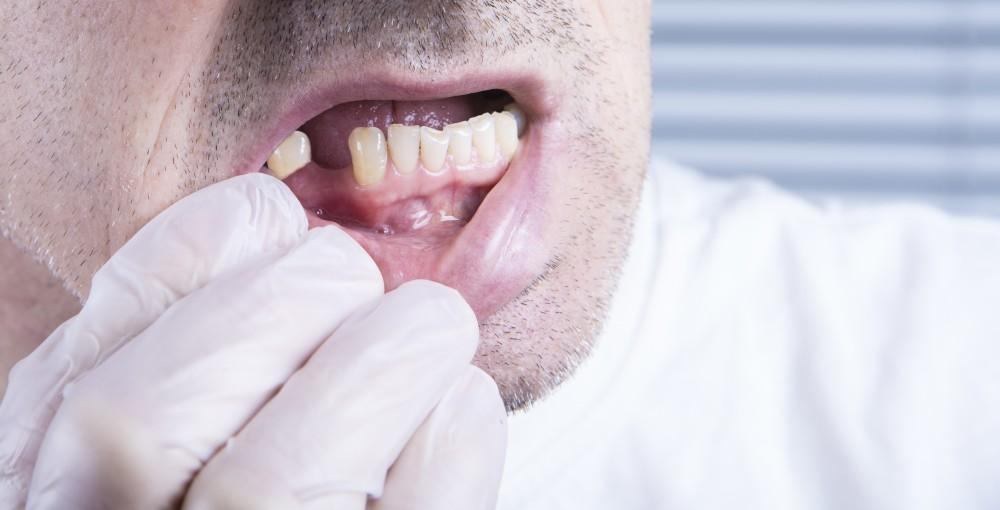 loose adult tooth