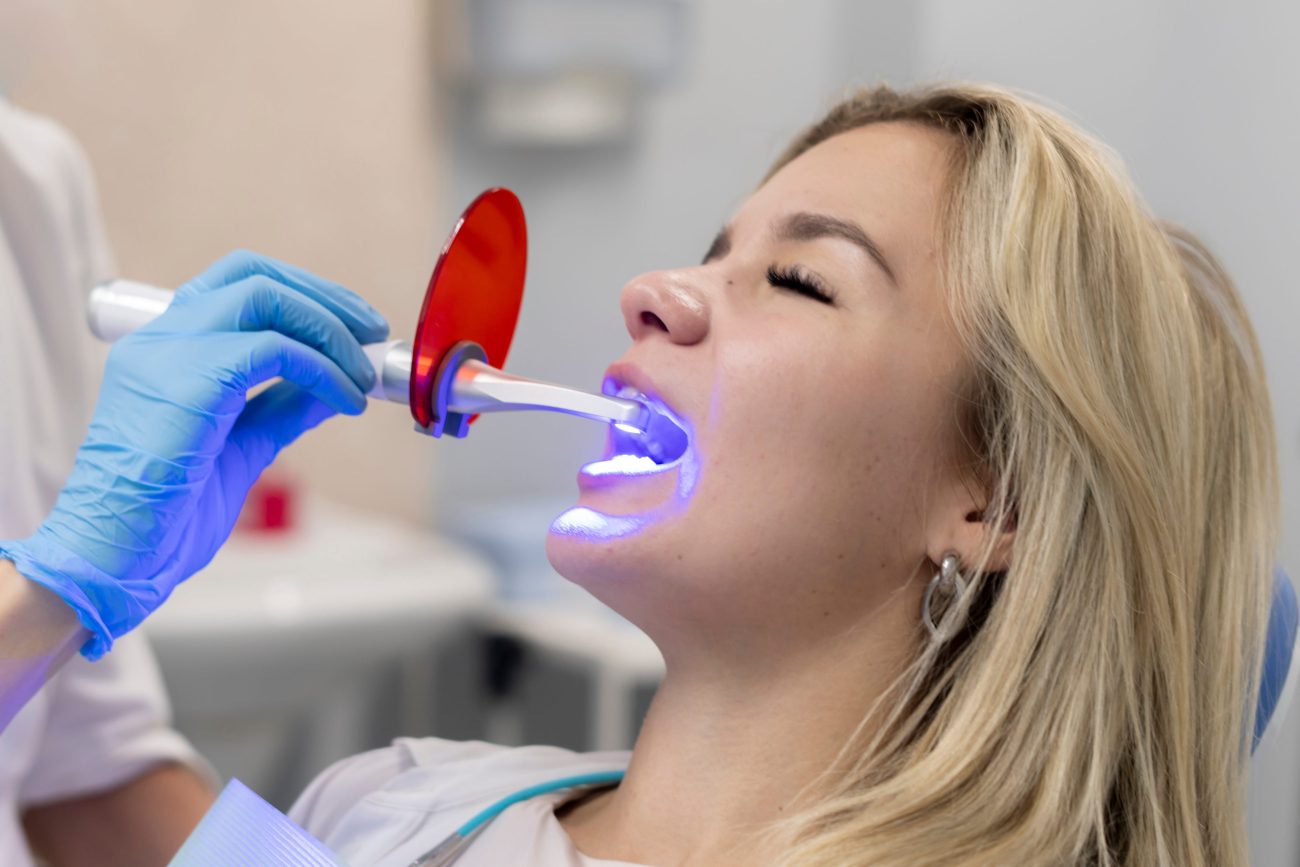teeth whitening options