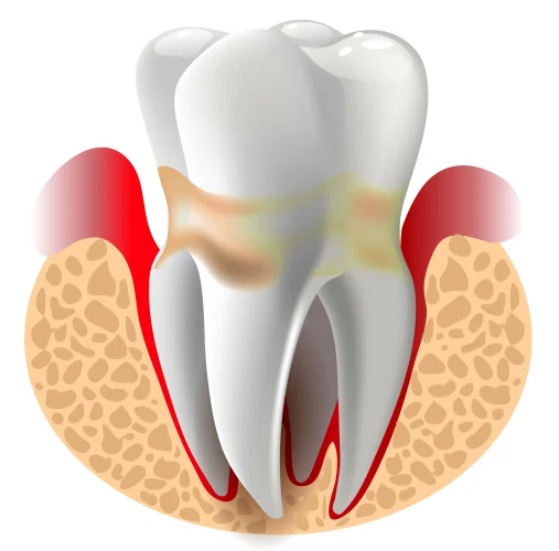 periodontist