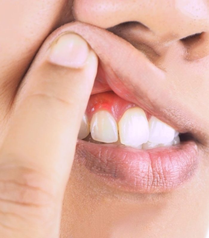 Periodontics red