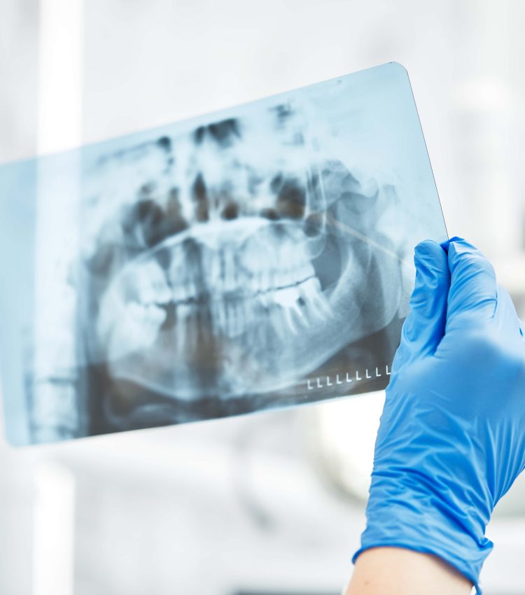 dental cavitations